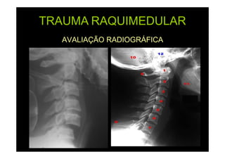TRAUMA RAQUIMEDULAR
AVALIAÇÃO RADIOGRÁFICA

 