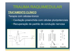 TRAUMA RAQUIMEDULAR
TRATAMENTO CLÍNICO
Terapia com células-tronco
• Cavitação preenchida com células pluripotenciais
• Recuperação de padrão de condução nervosa

 