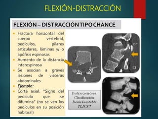 FLEXIÓN-DISTRACCIÓN
 