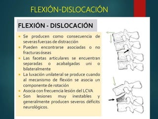 FLEXIÓN-DISLOCACIÓN
 