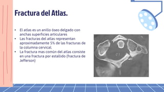 Fractura del Atlas.
• El atlas es un anillo óseo delgado con
anchas superficies articulares
• Las fracturas del atlas representan
aproximadamente 5% de las fracturas de
la columna cervical.
• La fractura mas común del atlas consiste
en una fractura por estallido (fractura de
Jefferson)
 