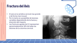 Fractura del Axis
• El axis es la vertebra cervical mas grande
y de forma mas inusual.
• Por lo tanto es susceptible de lesiones
variables dependiendo de la fuerza y
dirección del impacto.
• Las fracturas agudas de C2 representan
aproximadamente 18% de todas las
lesiones de la columna cervical.
 