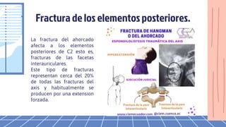 Fractura de los elementosposteriores.
La fractura del ahorcado
afecta a los elementos
posteriores de C2 esto es,
fracturas de las facetas
interauriculares.
Este tipo de fracturas
representan cerca del 20%
de todas las fracturas del
axis y habitualmente se
producen por una extension
forzada.
 