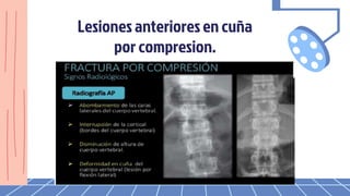 Lesiones anterioresen cuña
por compresion.
 