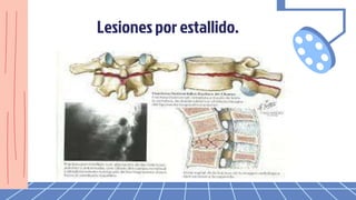 Lesiones por estallido.
 