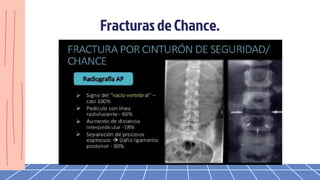 Fracturas de Chance.
 