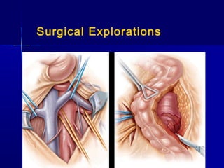 GenitoUrinary Trauma | PPT