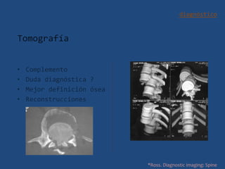 diagnóstico
Tomografía
• Complemento
• Duda diagnóstica ?
• Mejor definición ósea
• Reconstrucciones
*Ross. Diagnostic imaging: Spine
 