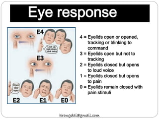 Eye response
4 = Eyelids open or opened,
tracking or blinking to
command
3 = Eyelids open but not to
tracking
2 = Eyelids closed but opens
to loud voice
1 = Eyelids closed but opens
to pain
0 = Eyelids remain closed with
pain stimuli
krongdai@gmail.com
 