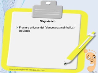 Diagnóstico
 Fractura articular del falange proximal (hallux)
izquierdo
 