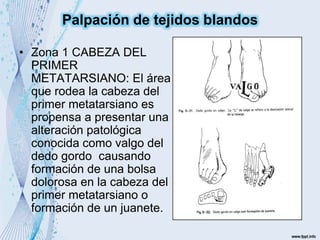 • Zona 1 CABEZA DEL
PRIMER
METATARSIANO: El área
que rodea la cabeza del
primer metatarsiano es
propensa a presentar una
alteración patológica
conocida como valgo del
dedo gordo causando
formación de una bolsa
dolorosa en la cabeza del
primer metatarsiano o
formación de un juanete.
Palpación de tejidos blandos
 