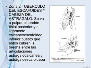 • Zona 2 TUBERCULO
DEL ESCAFOIDES Y
CABEZA DEL
ASTRAGALO: Se va
a palpar el tendón
tibial posterior y el
ligamento
calcaneoescafoideo
inferior puesto que
estos cubren la
brecha entre las
articulaciones
astragalocalcanea y
astrágaloescafoideoa
 