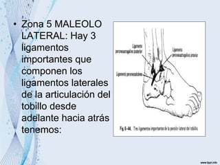 • Zona 5 MALEOLO
LATERAL: Hay 3
ligamentos
importantes que
componen los
ligamentos laterales
de la articulación del
tobillo desde
adelante hacia atrás
tenemos:
 