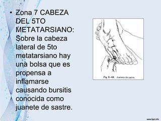 • Zona 7 CABEZA
DEL 5TO
METATARSIANO:
Sobre la cabeza
lateral de 5to
metatarsiano hay
una bolsa que es
propensa a
inflamarse
causando bursitis
conocida como
juanete de sastre.
 