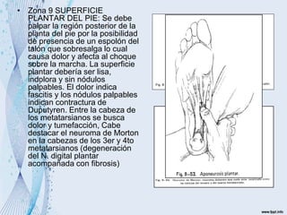 • Zona 9 SUPERFICIE
PLANTAR DEL PIE: Se debe
palpar la región posterior de la
planta del pie por la posibilidad
de presencia de un espolón del
talón que sobresalga lo cual
causa dolor y afecta al choque
sobre la marcha. La superficie
plantar debería ser lisa,
indolora y sin nódulos
palpables. El dolor indica
fascitis y los nódulos palpables
indican contractura de
Duputyren. Entre la cabeza de
los metatarsianos se busca
dolor y tumefacción, Cabe
destacar el neuroma de Morton
en la cabezas de los 3er y 4to
metatarsianos (degeneración
del N. digital plantar
acompañada con fibrosis)
 