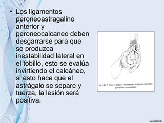 • Los ligamentos
peroneoastragalino
anterior y
peroneocalcaneo deben
desgarrarse para que
se produzca
inestabilidad lateral en
el tobillo, esto se evalúa
invirtiendo el calcáneo,
si esto hace que el
astrágalo se separe y
tuerza, la lesión será
positiva.
 
