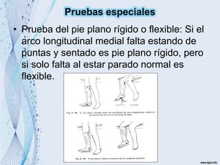 • Prueba del pie plano rígido o flexible: Si el
arco longitudinal medial falta estando de
puntas y sentado es pie plano rígido, pero
si solo falta al estar parado normal es
flexible.
Pruebas especiales
 