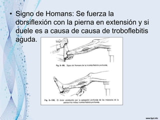 • Signo de Homans: Se fuerza la
dorsiflexión con la pierna en extensión y si
duele es a causa de causa de troboflebitis
aguda.
 