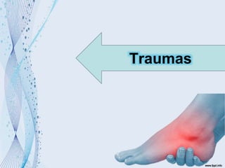 Traumas
 