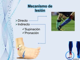 Mecanismo de
lesión
Directo
Indirecto
Supinación
Pronación
 