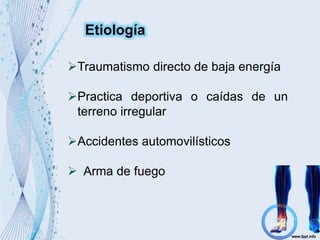 Traumatismo directo de baja energía
Practica deportiva o caídas de un
terreno irregular
Accidentes automovilísticos
 Arma de fuego
Etiología
 