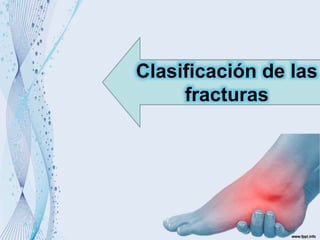 Clasificación de las
fracturas
 
