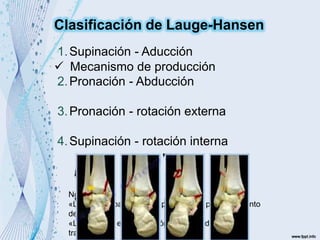 1.Supinación - Aducción
2.Pronación - Abducción
3.Pronación - rotación externa
4.Supinación - rotación interna
Nota:
«La primera palabra es la posición del pie al momento
de la lesión»
«La segunda es la dirección o sentido de la fuerza
traumática»
Clasificación de Lauge-Hansen
 Mecanismo de producción
 