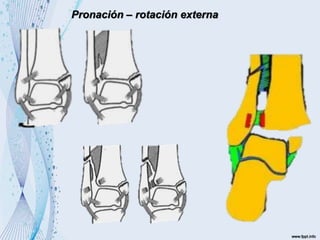 Pronación – rotación externa
 