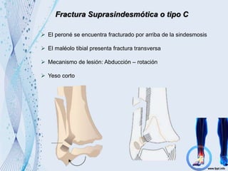 Fractura Suprasindesmótica o tipo C
 El peroné se encuentra fracturado por arriba de la sindesmosis
 El maléolo tibial presenta fractura transversa
 Mecanismo de lesión: Abducción – rotación
 Yeso corto
 