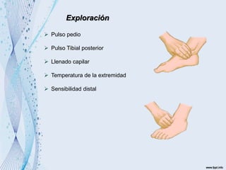 Exploración
 Pulso pedio
 Pulso Tibial posterior
 Llenado capilar
 Temperatura de la extremidad
 Sensibilidad distal
 