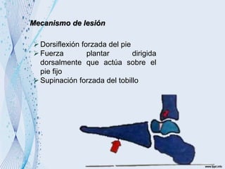 Mecanismo de lesión
Dorsiflexión forzada del pie
Fuerza plantar dirigida
dorsalmente que actúa sobre el
pie fijo
Supinación forzada del tobillo
 