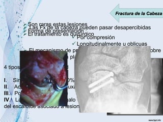 Fractura de la Cabeza
Son raras estas lesiones
Forma de presentación :
 Por compresión
 Longitudinalmente u oblicuas
 El mecanismo de producción es una carga axial sobre
un pie en flexión plantar
4 tipos según su severidad
I. Sin desplazamiento (10%)
II. Acompañadas de subluxación (50%)
III. Por dorsiflexión (85%)
IV. La cabeza del astragalo se disloca
del escafoide asociado a lesion I y II
 Las Fx de la cabeza pueden pasar desapercibidas
El tratamiento es quirúrgico
 