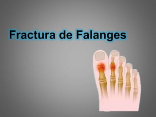 Proyecciones radiológicas
A-P, Lateral y Oblicua de pie
Fractura de Falanges
 