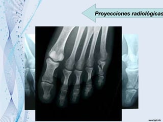 Proyecciones radiológicas
 