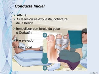 Conducta Inicial
 AINEs
 Si la lesión es expuesta, cobertura
de la herida
Inmovilizar con férula de yeso
o Corbatín
Pie elevado
Hielo local
 
