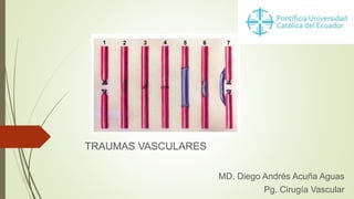 TRAUMAS VASCULARES
MD. Diego Andrés Acuña Aguas
Pg. Cirugía Vascular
 