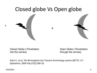 Closed globe Vs Open globe
Closed Globe ( Penetration
into the cornea)
Open Globe ( Penetration
through the cornea)
Kuhn F., et al, The Birmingham Eye Trauma Terminology system (BETT): J Fr
Ophtalmol. 2004 Feb;27(2):206-10.
4/25/2023 3
 