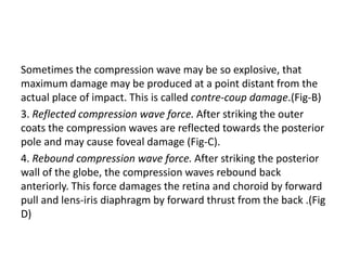 Sometimes the compression wave may be so explosive, that
maximum damage may be produced at a point distant from the
actual place of impact. This is called contre-coup damage.(Fig-B)
3. Reflected compression wave force. After striking the outer
coats the compression waves are reflected towards the posterior
pole and may cause foveal damage (Fig-C).
4. Rebound compression wave force. After striking the posterior
wall of the globe, the compression waves rebound back
anteriorly. This force damages the retina and choroid by forward
pull and lens-iris diaphragm by forward thrust from the back .(Fig
D)
 