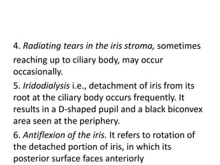 4. Radiating tears in the iris stroma, sometimes
reaching up to ciliary body, may occur
occasionally.
5. Iridodialysis i.e., detachment of iris from its
root at the ciliary body occurs frequently. It
results in a D-shaped pupil and a black biconvex
area seen at the periphery.
6. Antiflexion of the iris. It refers to rotation of
the detached portion of iris, in which its
posterior surface faces anteriorly
 