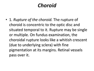 Choroid
• 1. Rupture of the choroid. The rupture of
choroid is concentric to the optic disc and
situated temporal to it. Rupture may be single
or multiple. On fundus examination, the
choroidal rupture looks like a whitish crescent
(due to underlying sclera) with fine
pigmentation at its margins. Retinal vessels
pass over it.
 