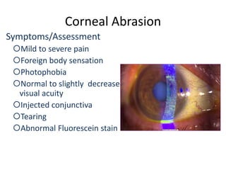 Corneal Abrasion
Symptoms/Assessment
Mild to severe pain
Foreign body sensation
Photophobia
Normal to slightly decreased
visual acuity
Injected conjunctiva
Tearing
Abnormal Fluorescein stain
 