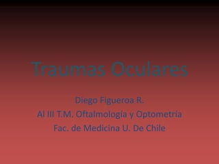 Traumas Oculares
Diego Figueroa R.
Al III T.M. Oftalmología y Optometría
Fac. de Medicina U. De Chile
 