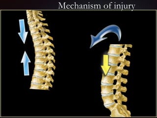 Imaging of thoracic spine Trauma | PPTX