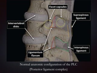 Imaging of thoracic spine Trauma | PPTX