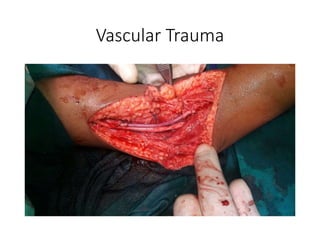 Vascular Trauma
 