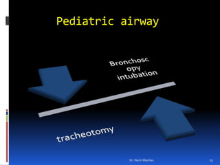      Pediatric airway15Dr. Naim Manhas