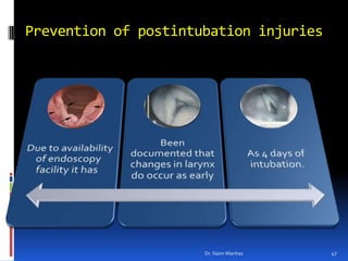 Prevention of postintubation injuries Dr. Naim Manhas47