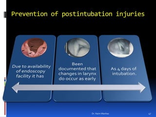 Prevention of postintubation injuries <br />Dr. Naim Manhas<br />47<br />