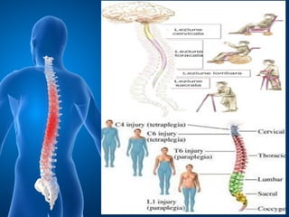 Traumat.vertebro medulare