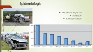 Epidemiologia
 70% entre los 20 y 40 años
 Hombres 4:1
 8-20% son bilaterales
 